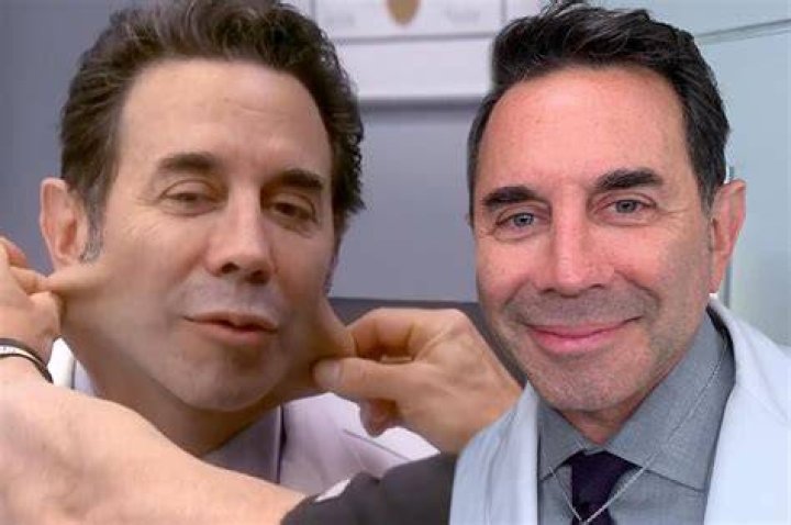 Dr Nassif said he would need to inject some fat to correct the botched face lift. Pictured after