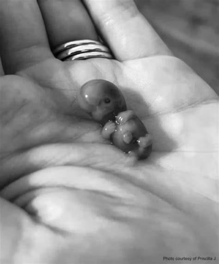 She miscarried her baby